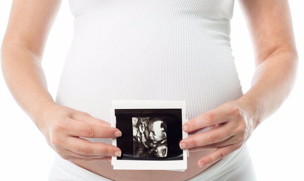 Pregnant woman with 4D ultrasound